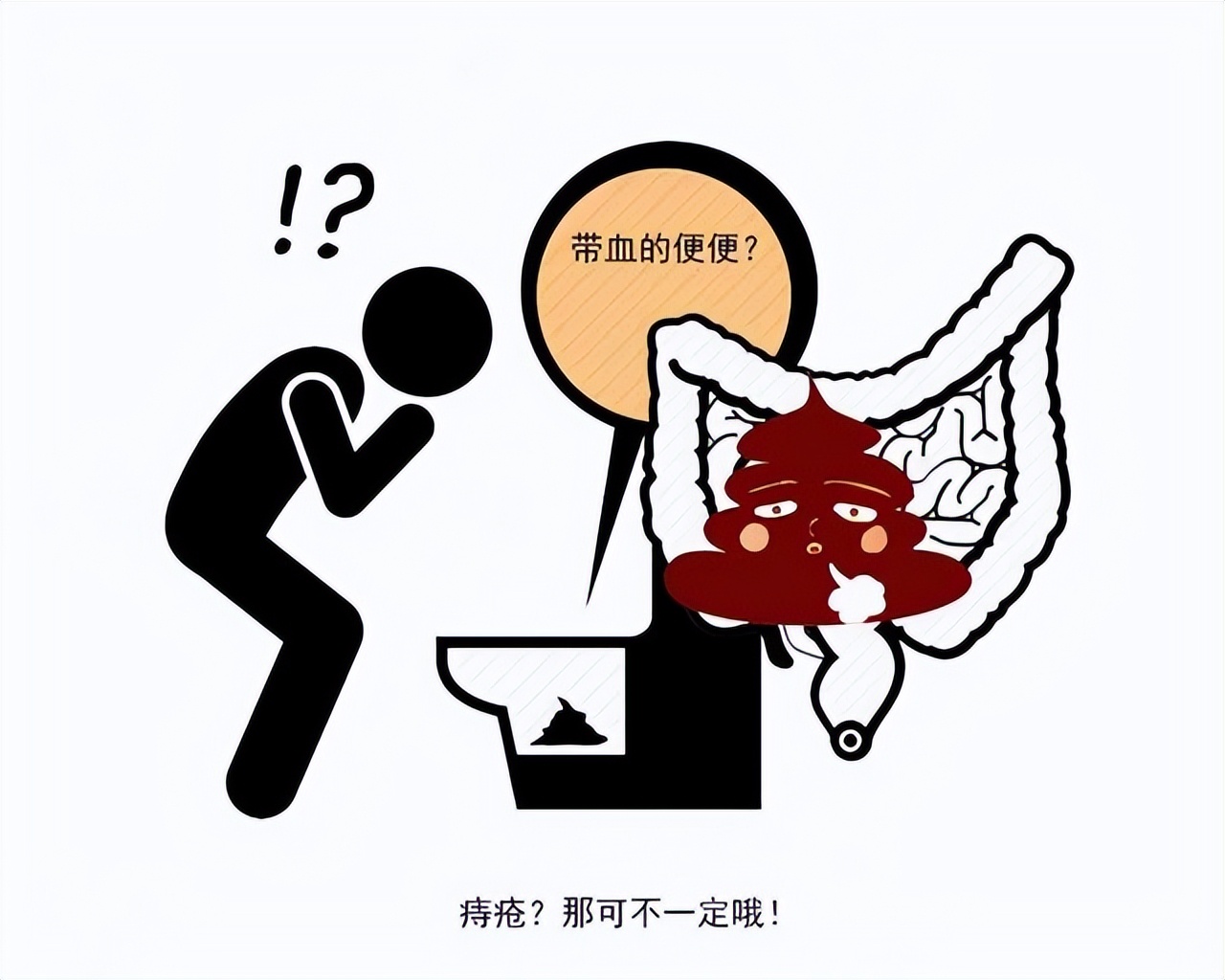 为什么痔疮久治不愈,为什么痔疮不治而愈