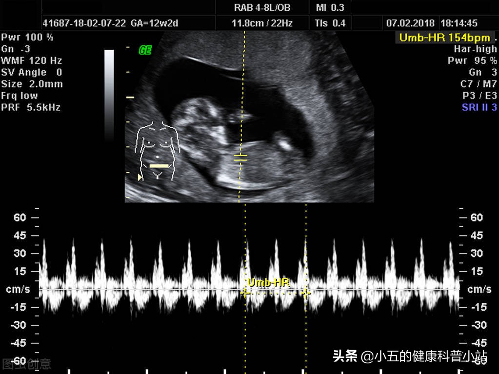 慢性心衰能长期服用螺内酯吗,心衰患者螺内酯的用法