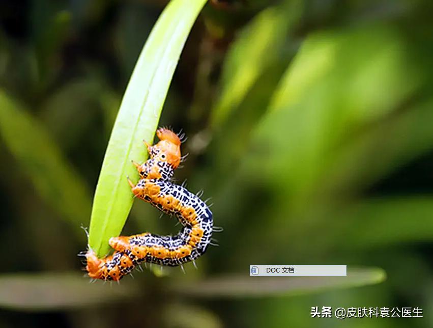 蚊虫叮咬引起的皮炎一年了没好,夏季有哪些虫叮咬会红肿