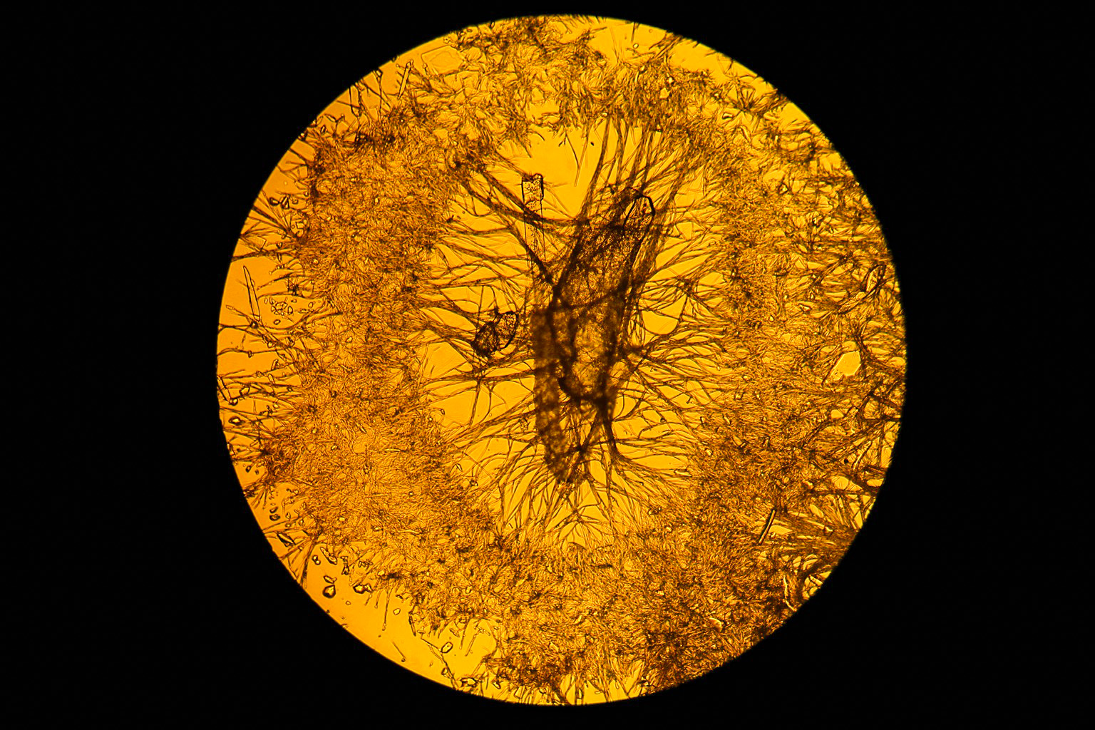 显微镜下结晶图片,显微镜下针状结晶图