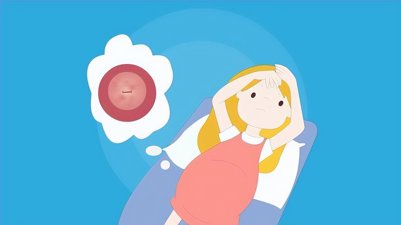 宫颈癌早期有三处疼痛的原因,宫颈癌的3个早期信号容易被忽略