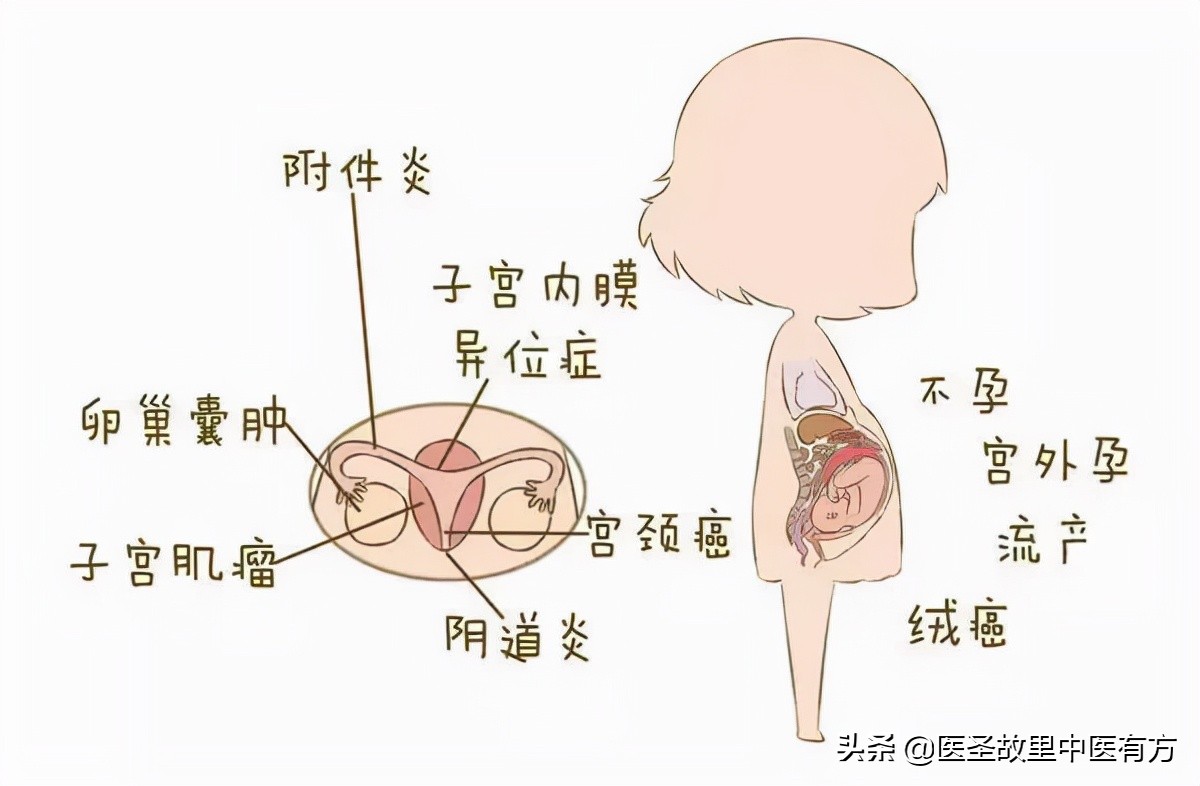 温经汤治月经不调痛经,妇科祖方温经汤