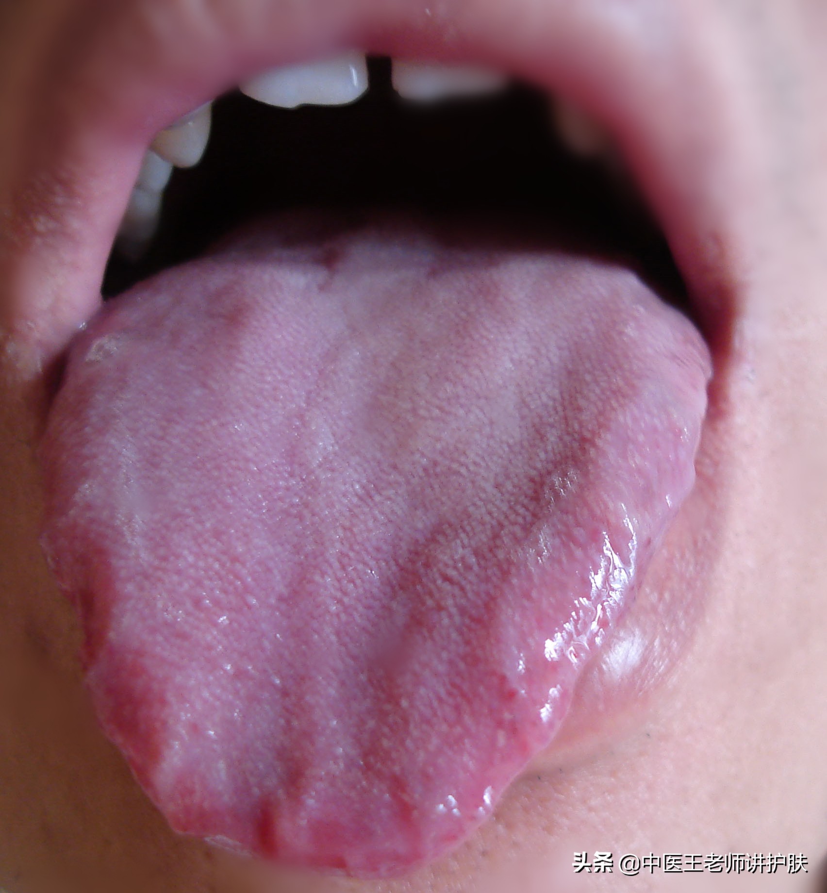 治毒疮最快的中医偏方,治疗各种疮的偏方