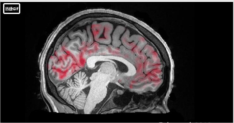 睡少了会加速衰老,睡少了脑子会变笨吗