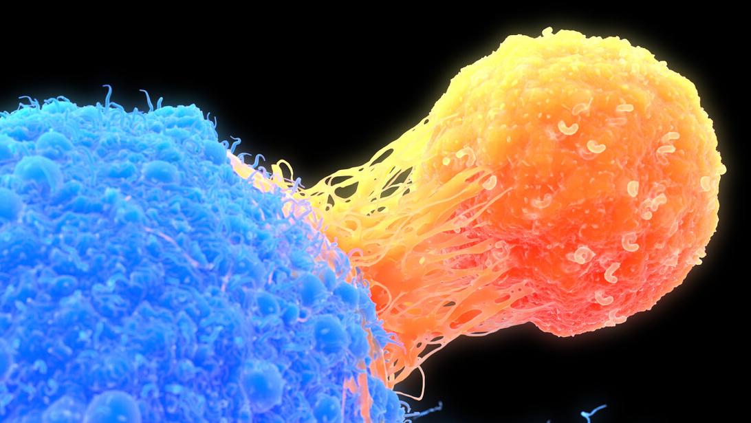 身体出现5种暗示癌症找上门,身体出现什么信号说明体内有癌