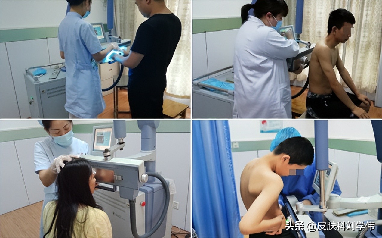 白癜风越治越多三个方法彻底治好,治疗儿童白癜风会存在哪些误区