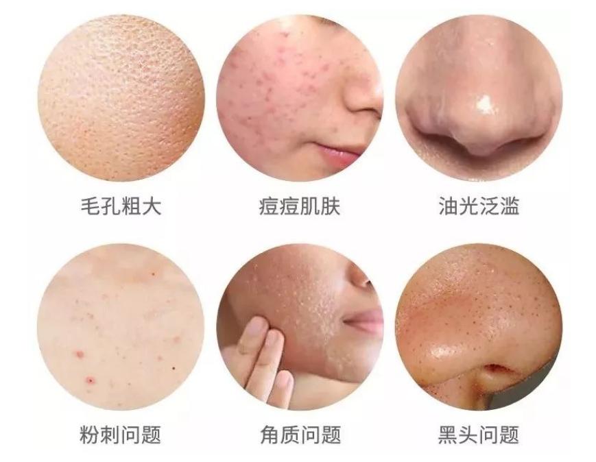 三年没洗枕套可以吗,三年没洗澡长寄生虫