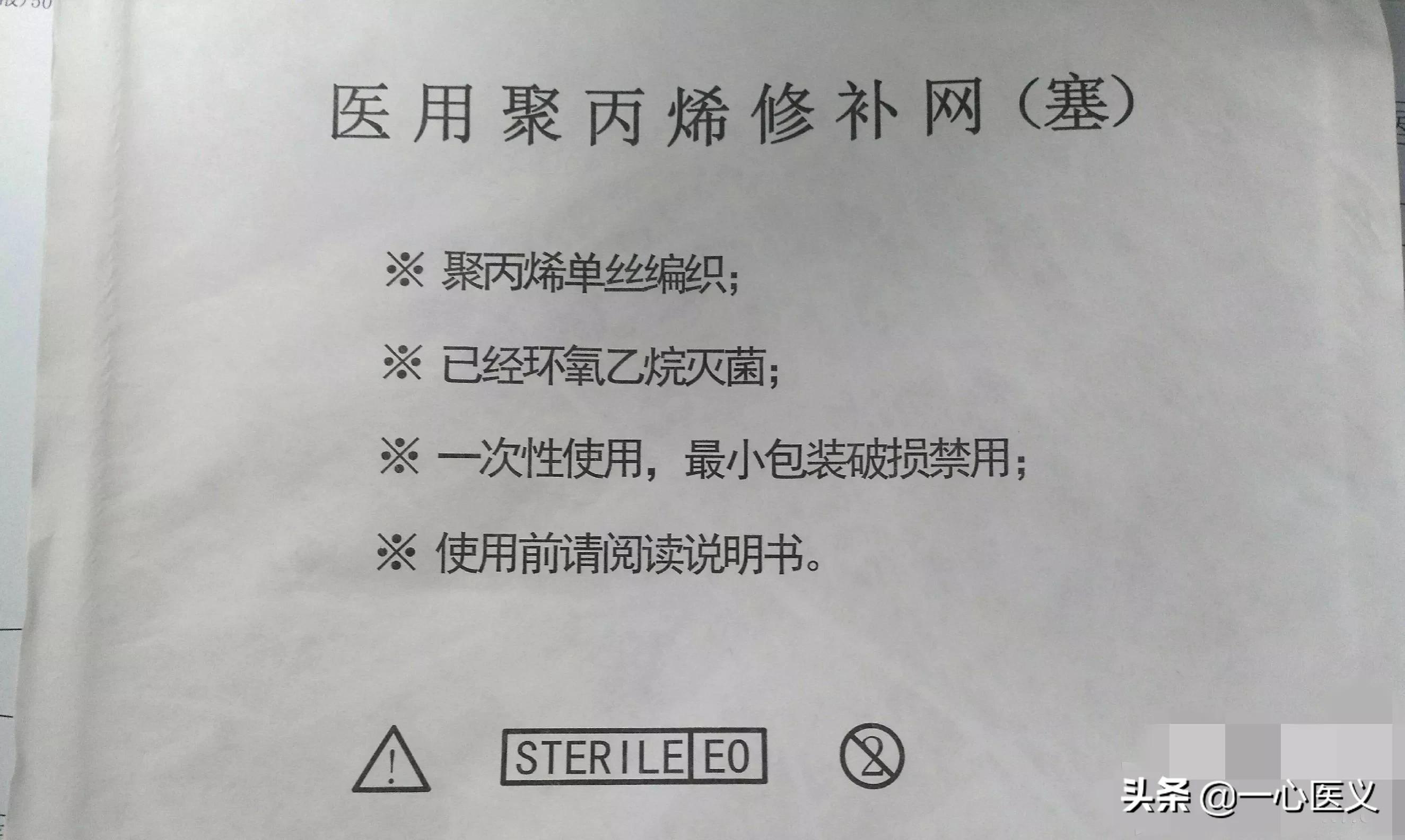 无张力疝气修补后一辈子不复发吗,腹股沟疝气无张力修补术会复发吗