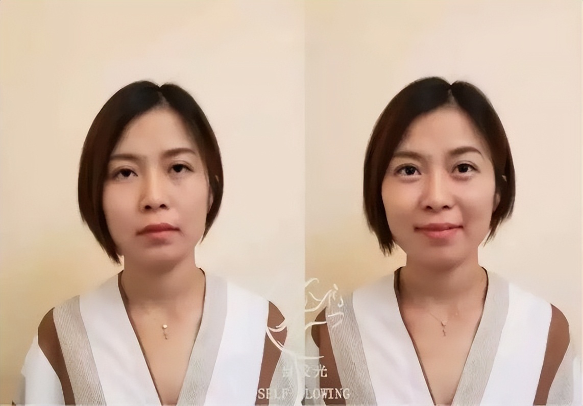 显老的罪魁祸首是什么,显老除了法令纹还有什么纹