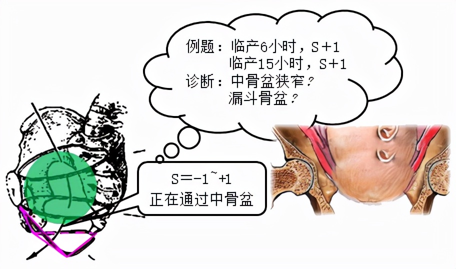 胎儿屁股在右侧是什么胎位,胎位roa屁股在左边还是右边