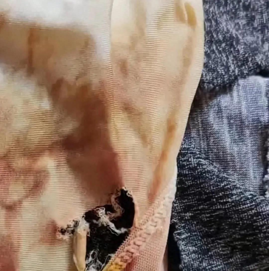 女子夜跑被恶犬咬伤后续,25岁未婚女子夜跑被恶犬咬伤后续