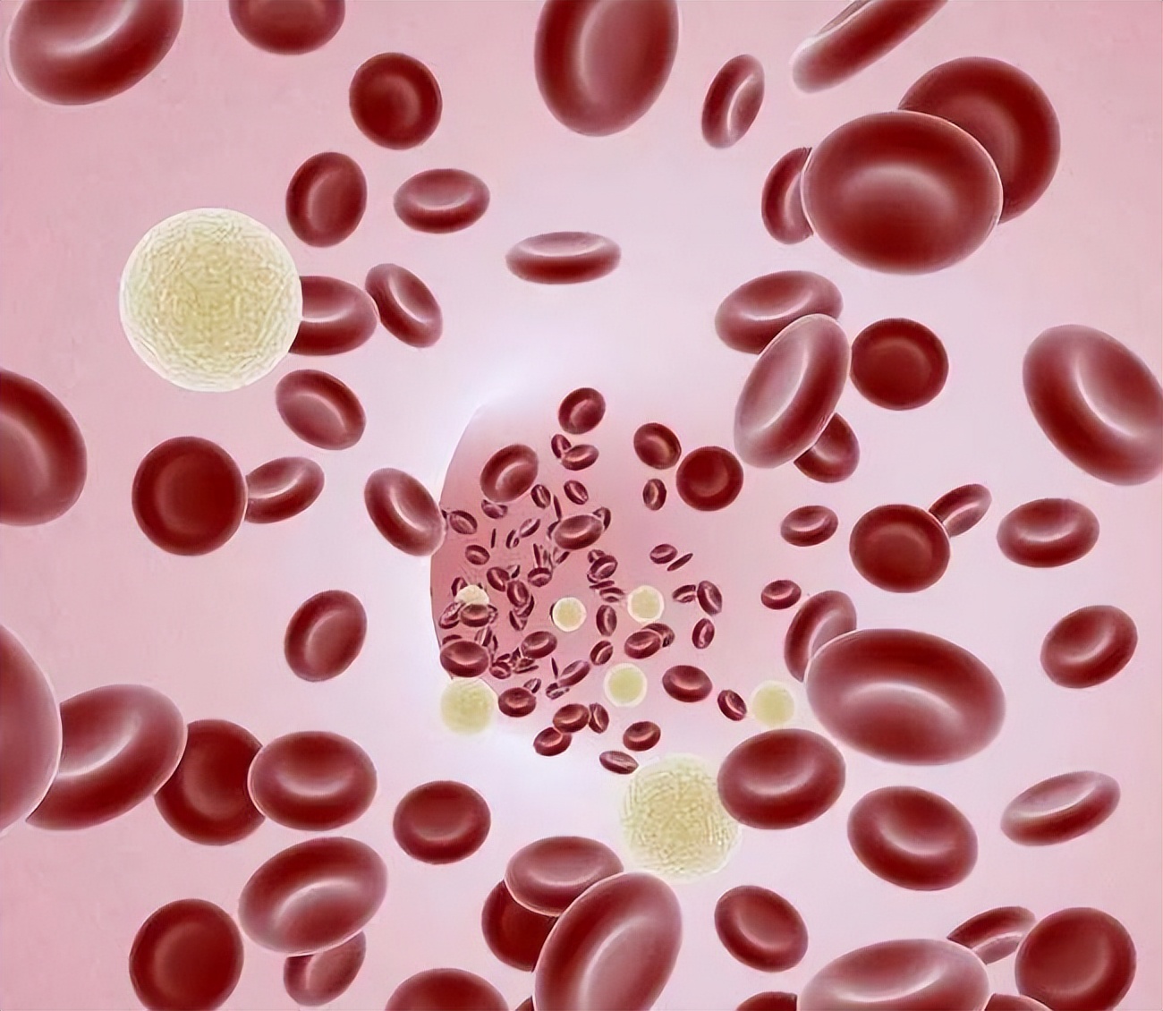 为什么不建议女人去做某些手术，医生用一个个血淋淋的例子告诉你