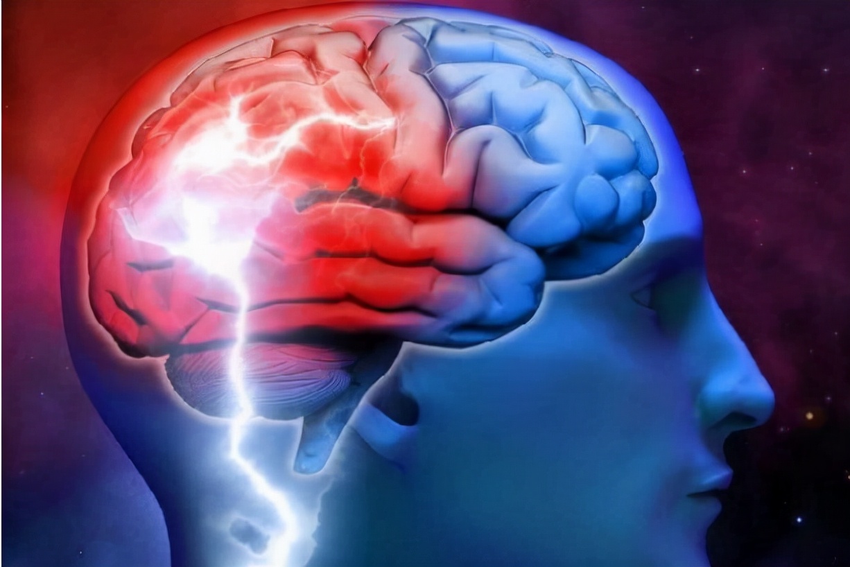 癫痫治疗最好的办法是什么,癫痫治疗最有效的办法有哪些