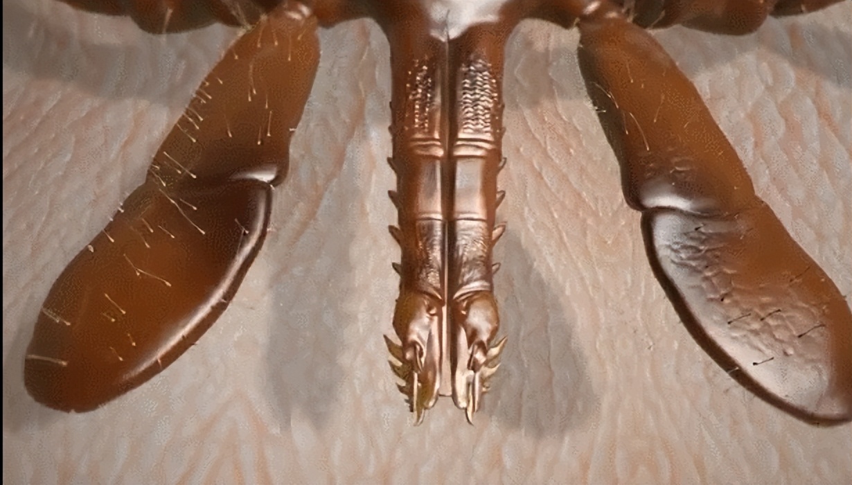 五种必须远离的巨型毒虫,医生提醒近期警惕这3种传染病