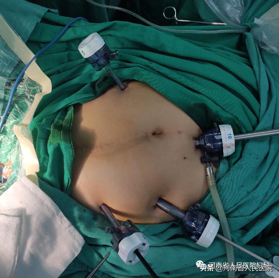 80后的难言之隐,难言之隐第十二集