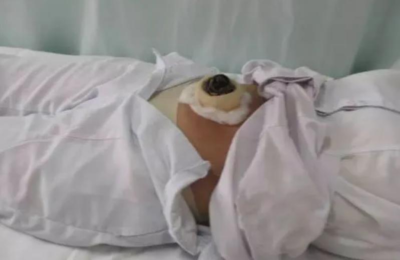 早上起不来，晚上不想睡？多半是湿气重，中医告诉你怎么祛湿