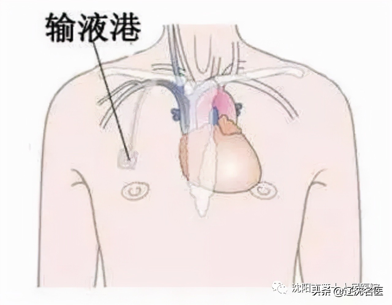 沈阳市第十一人民医院简介,沈阳第十人民医院官网