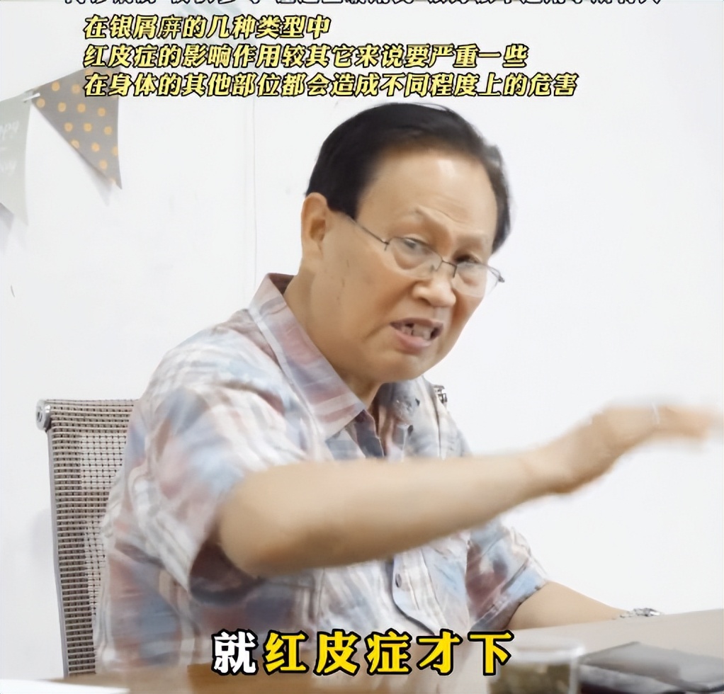 公路领导红皮型银屑病拒绝住院，何教授迎难而上：治就治