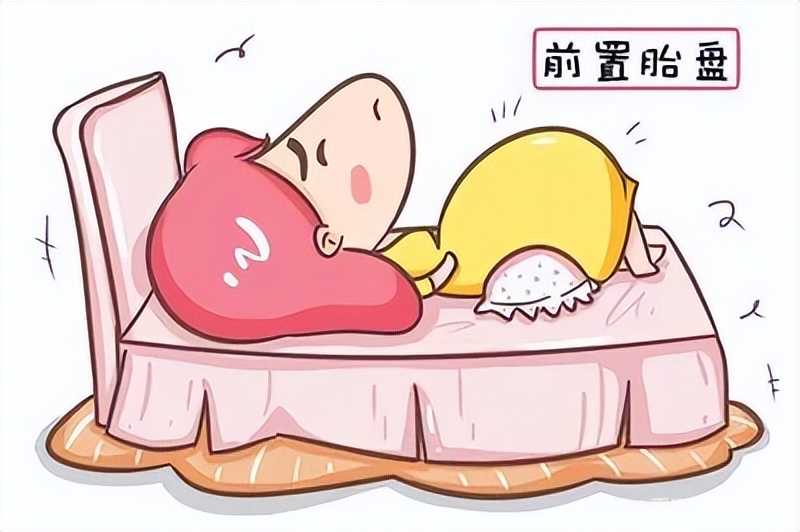 十月怀胎不易无特殊情况,孕三十一周前置胎盘怎么办