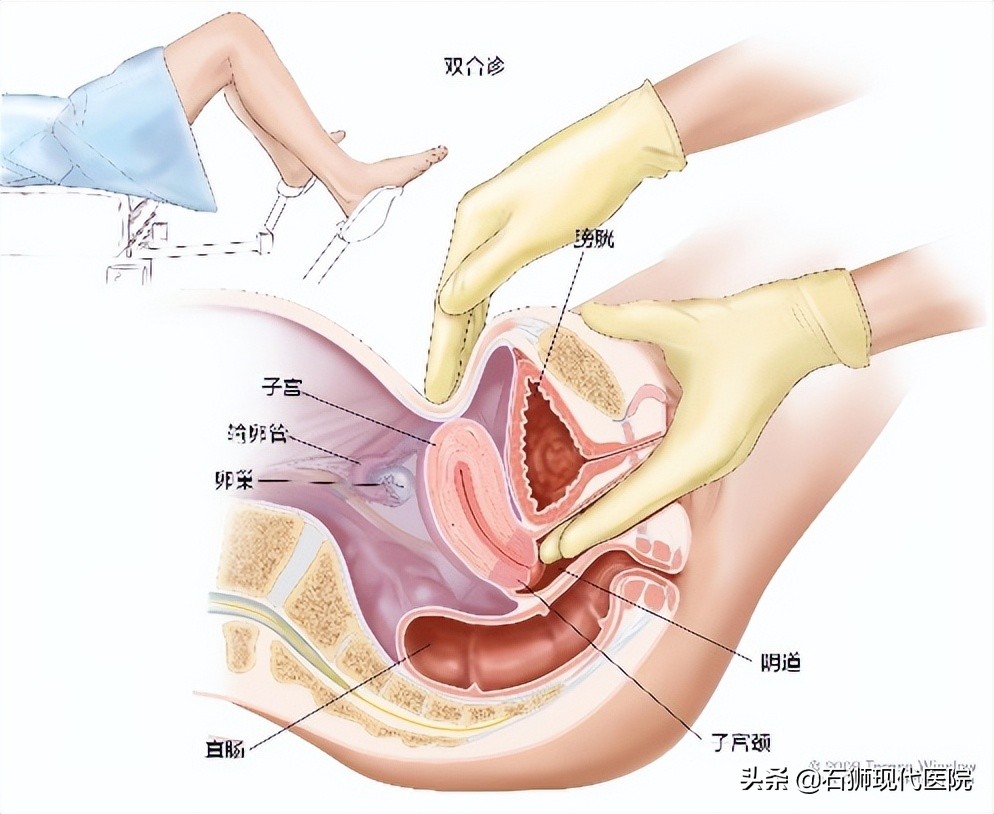 48岁的女人妇科体检应该做哪几项,妇科检查怎么查