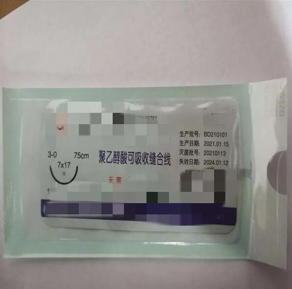 伤口缝合留疤还是不缝合留疤,可吸收的缝合线有疤痕吗