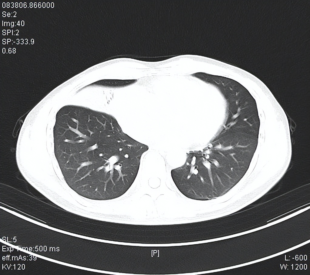 苏州抑郁症诊断,苏州大学人民医院治疗抑郁症