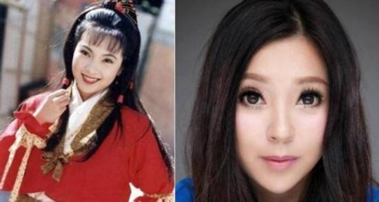 老演员整容脸变形,老年人整容前后照片