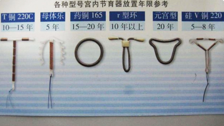 节育环萎缩嵌到肉里能取出来吗,节育环一直不取会怎么样