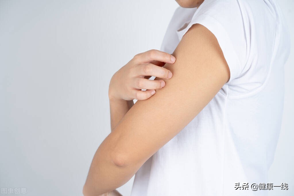 啃指甲手指起倒刺怎么回事,咬指甲手指头有倒刺怎么办