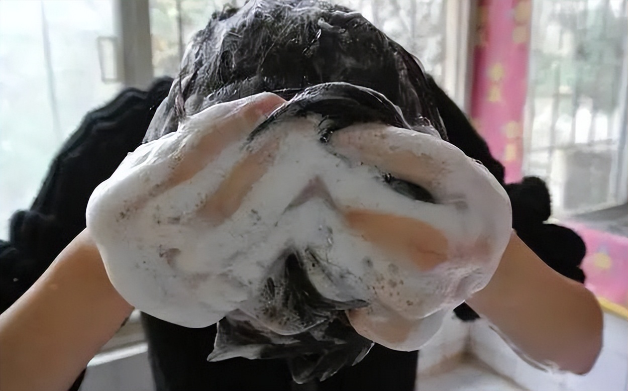 头皮上长红疙瘩和黄色脓包,头皮经常起小脓包疙瘩很疼