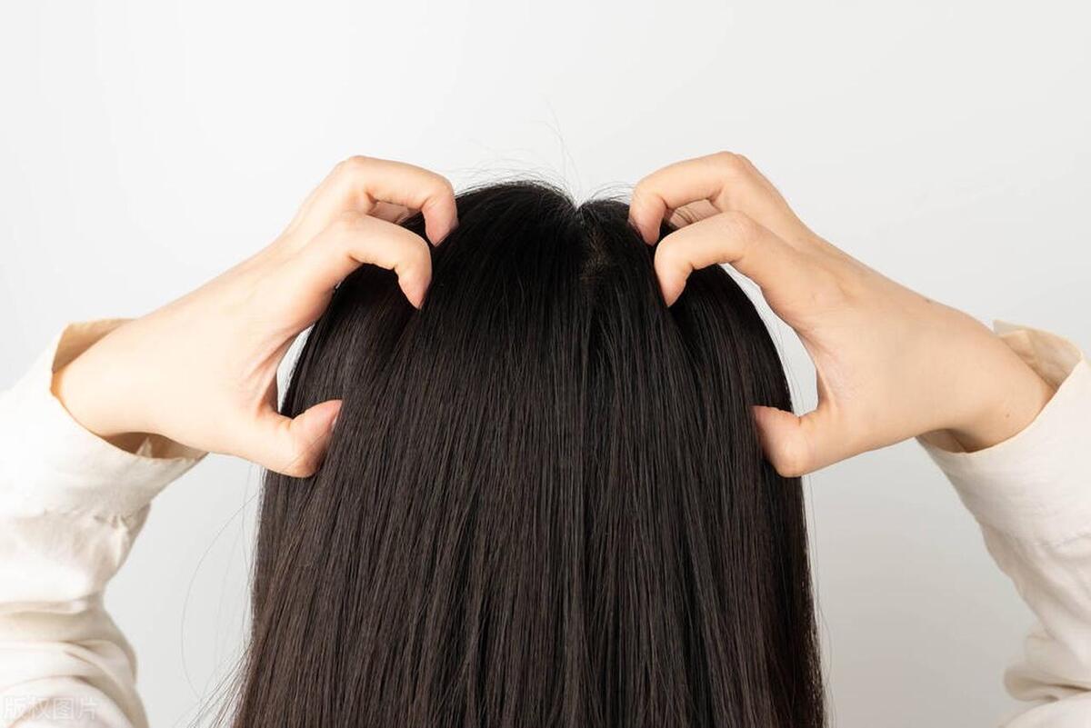 头皮出油特别厉害是什么原因,头皮出油厉害什么原因