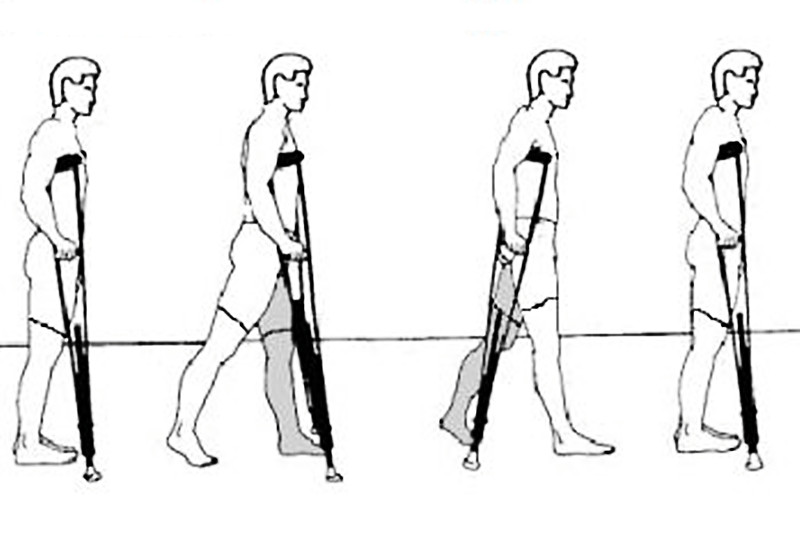 骨折后正确使用拐杖方法,骨折后打石膏怎么使用拐杖