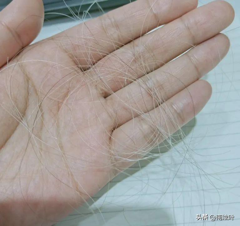 为什么压力大时会长白头发？这些习惯可以控制白发增多！