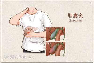 胆囊炎早晨最佳食谱,胆囊炎每日正确食谱