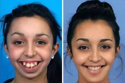 世界六大奇葩审美标准,世界上畸形的审美