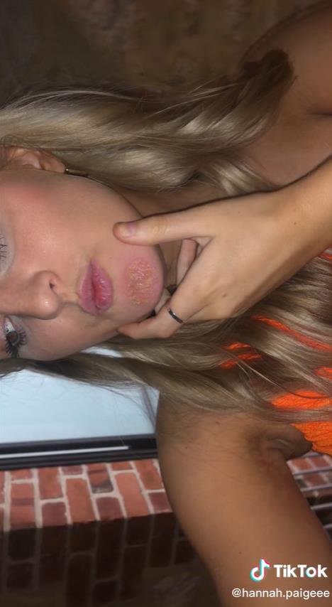 澳洲妹子和男友接吻,澳大利亚女子与男友接吻