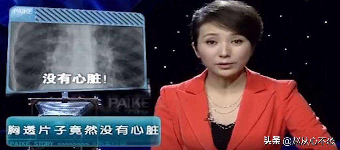 06年，湖北女孩腹疼难忍，胸透看不见心脏，医生：心掉进了肚子里