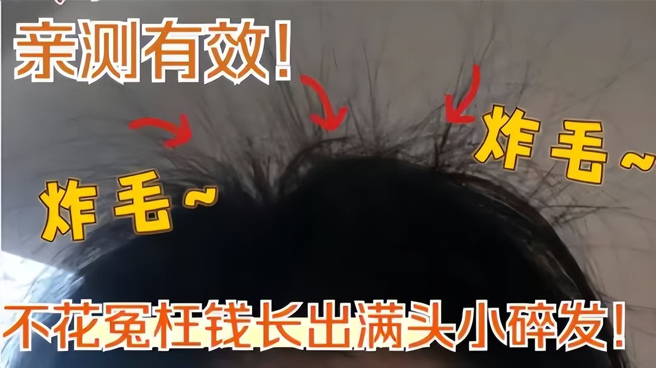 生发洗发水大牌第一名,发根干枯防脱生发洗发水排名第一