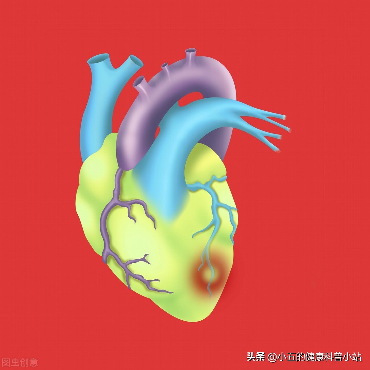 糖尿病长期吃药肾受损怎么办,糖尿病如何损伤血管的