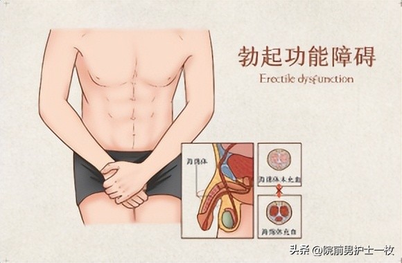 世界男性健康日健康误区,男性健康日科普先行