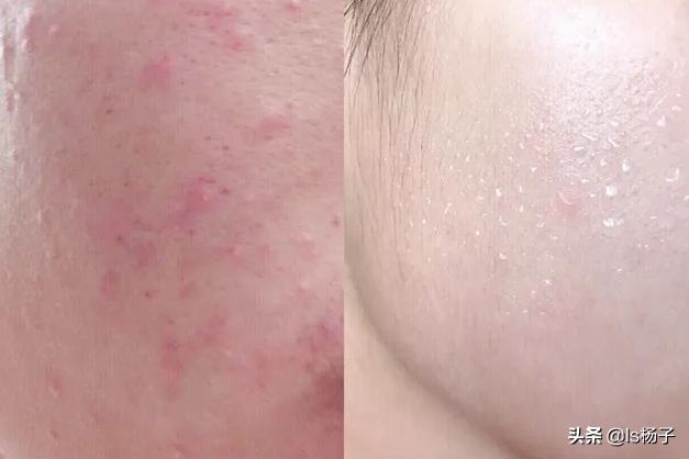 肤色变白最有效的方法,如何让又黄又暗肤色变白