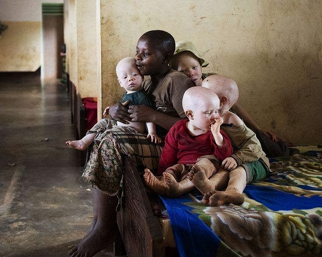 非洲最特殊的人群：血液堪比黄金，遗骸卖上百万，却无法健康成长