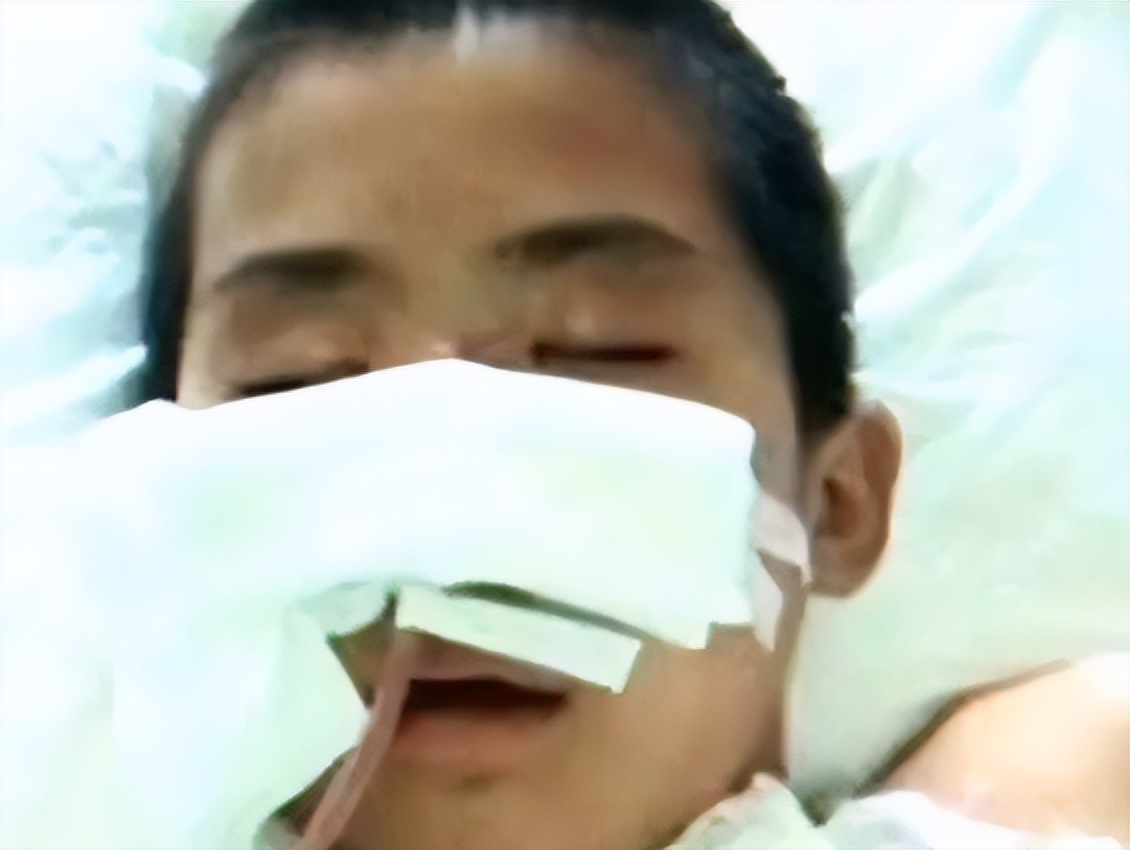 山东男孩被高压气打入身体,男子被高压枪充气后续