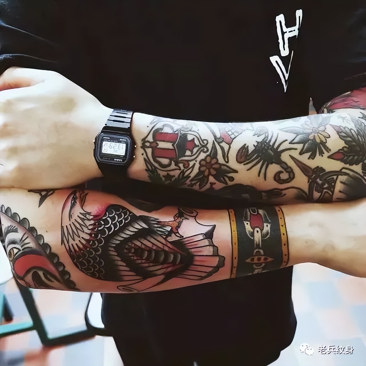 纹身增生疤痕怎么去除,纹身为什么会有增生