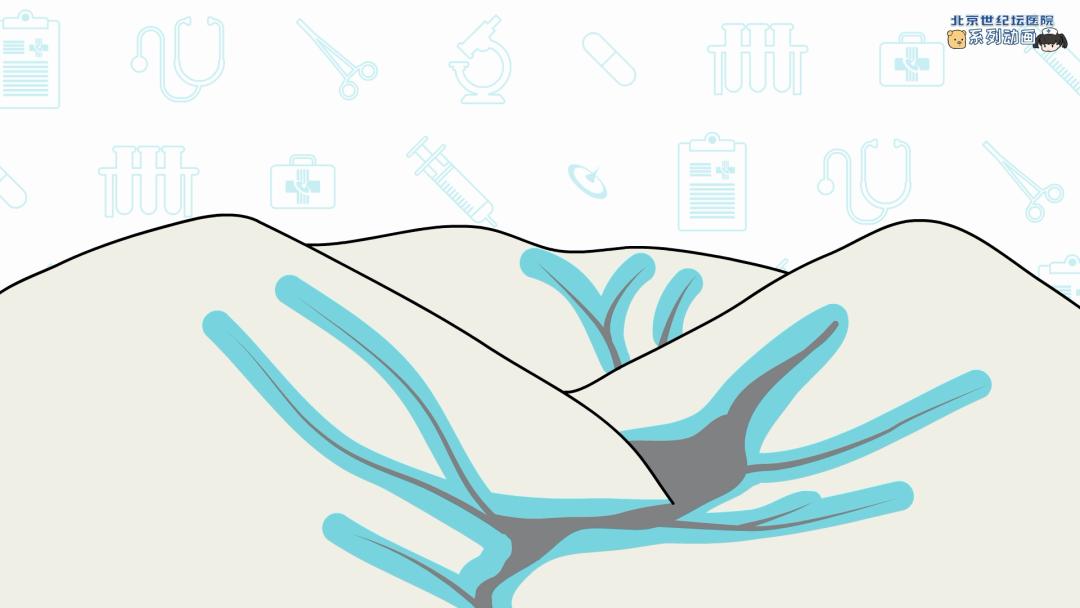 健康科普龋齿窝沟封闭,预防蛀牙科普视频