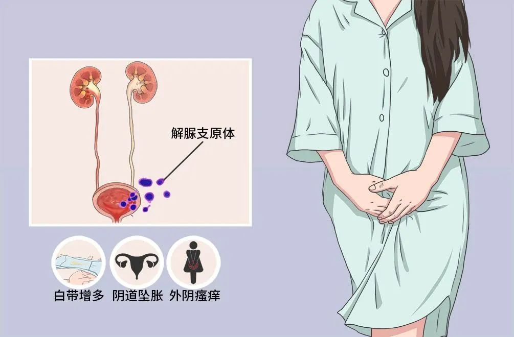 一文了解肺炎支原体,解脲支原体第一例怎样引起的