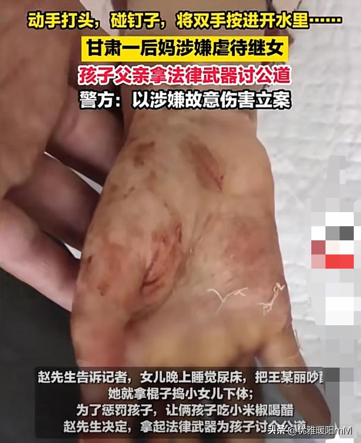 恶毒后妈虐待孩子真实事件,恶毒后妈虐待孩子事件