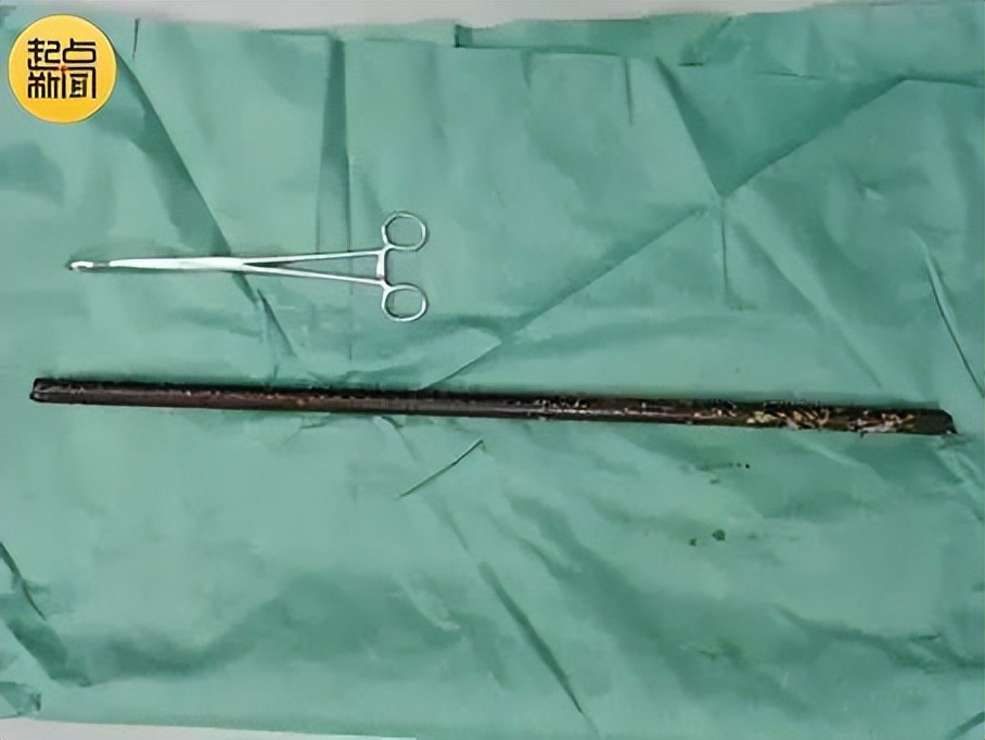 男子工地滑倒被钢筋刺穿身体,男子工地坠落被钢筋刺穿腹部