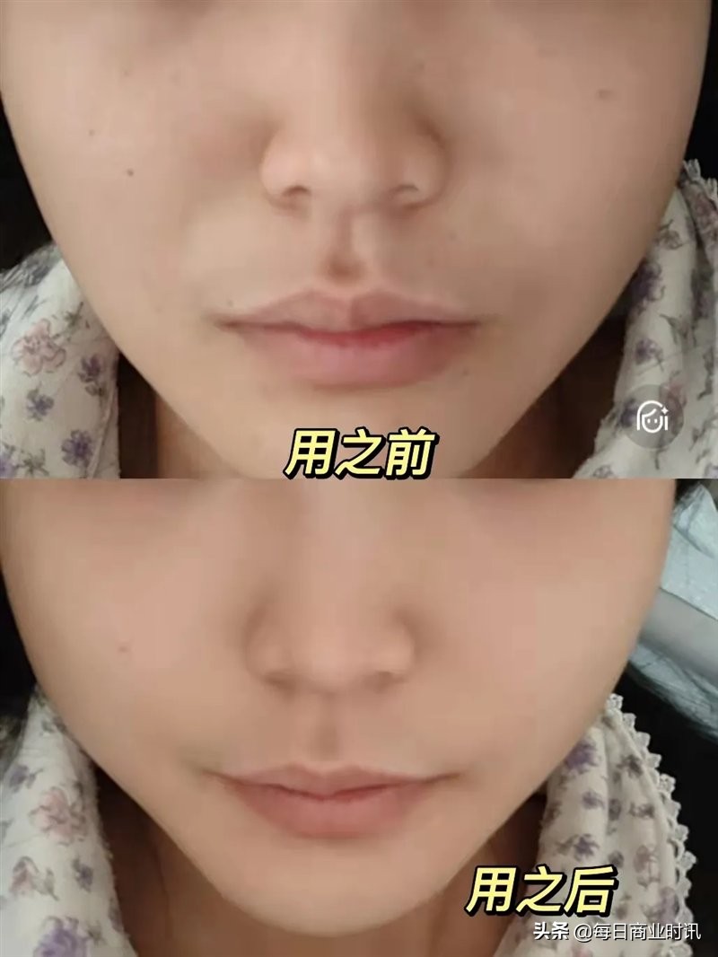 缦霖眼部精华,缦霖极光亮颜精华液