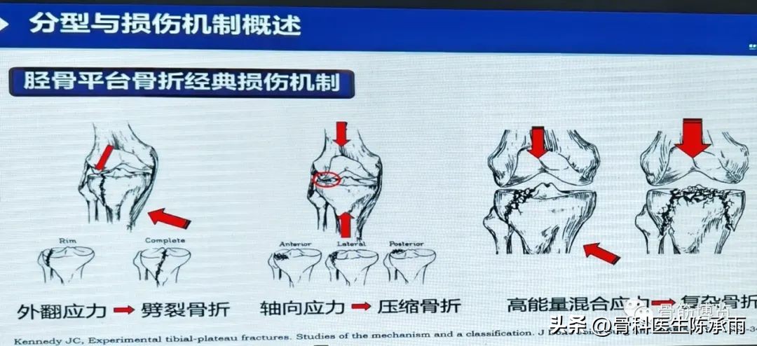 国家卫健委主办的骨创伤专项能力培训项目----下肢损伤学习班